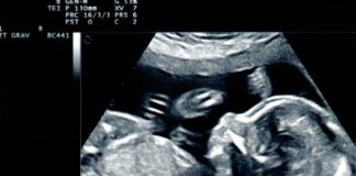 Kluczowe informacje o ultrasonografii w trakcie ciąży